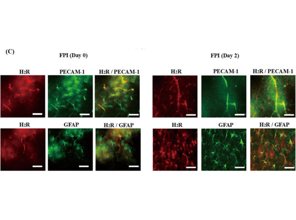 Immunohistochemistry using Mouse FITC